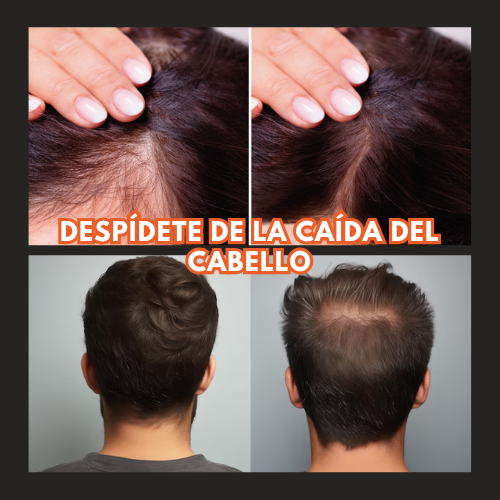 OUHOE - Crecimiento natural